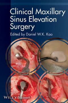 portada Clinical Maxillary Sinus Elevation Surgery