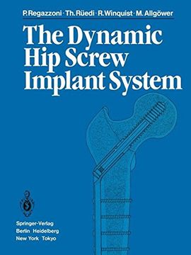 portada the dynamic hip screw implant system (en Inglés)