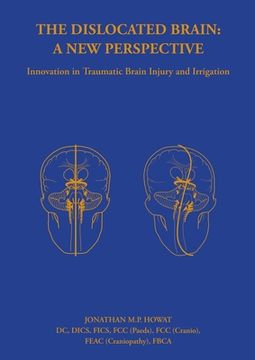 portada The Dislocated Brain: A New Perspective (in English)