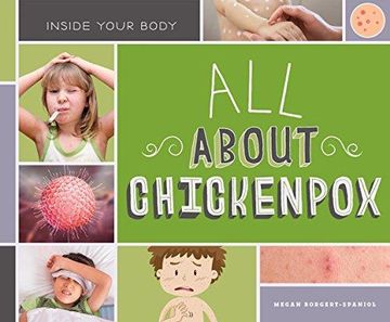 portada All About Chickenpox 