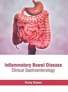 portada Inflammatory Bowel Disease: Clinical Gastroenterology 