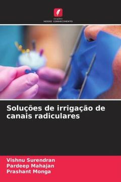 portada Soluções de Irrigação de Canais Radiculares (in Portuguese)