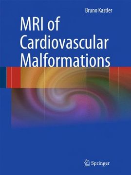 portada Mri of Cardiovascular Malformations (en Inglés)