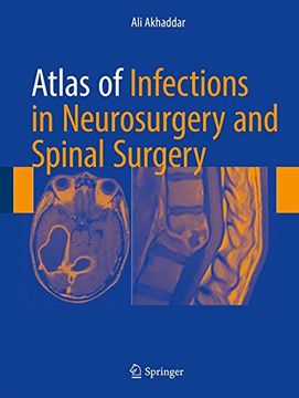 portada Atlas of Infections in Neurosurgery and Spinal Surgery