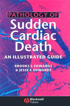 portada pathology of sudden cardiac death: an illustrated guide (in English)