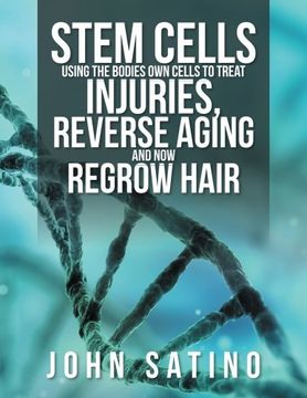 portada Stem Cells Using the Bodies Own Cells to Treat Injuries, Reverse Aging and Now Regrow Hair