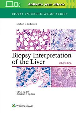 portada Biopsy Interpretation of the Liver (en Inglés)