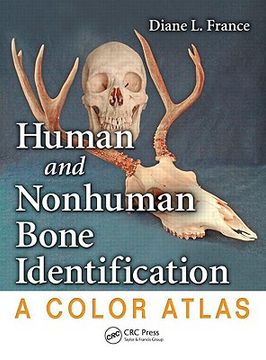 Human and Nonhuman Bone Identification: A Color Atlas