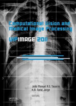 portada computational vision and medical image processing: vipimage 2011 (en Inglés)