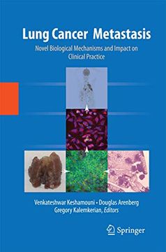 portada Lung Cancer Metastasis: Novel Biological Mechanisms and Impact on Clinical Practice (en Inglés)
