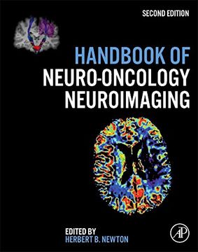 portada Handbook of Neuro-Oncology Neuroimaging (en Inglés)