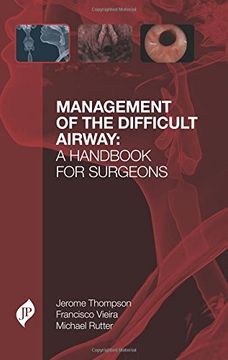 portada Management of the Difficult Airway: A Handbook for Surgeons: A Handbook for Surgeons: (in English)