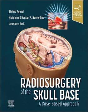 portada Radiosurgery of the Skull Base: A Case-Based Approach (en Inglés)