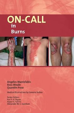 portada On-Call in Burns (en Inglés)