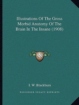 portada illustrations of the gross morbid anatomy of the brain in the insane (1908)