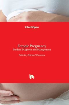 portada Ectopic Pregnancy: Modern Diagnosis and Management (en Inglés)