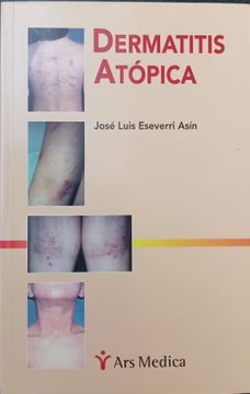 portada Dermatitis Atópica Jose Luis Echeverri Asin  Ars Medica