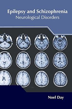 portada Epilepsy and Schizophrenia: Neurological Disorders (en Inglés)