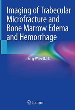 portada Imaging of Trabecular Microfracture and Bone Marrow Edema and Hemorrhage (in English)