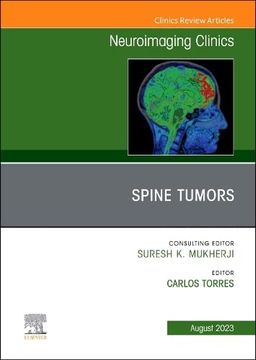 portada Mri and Traumatic Brain Injury, an Issue of Neuroimaging Clinics of North America (Volume 33-2) (The Clinics: Radiology, Volume 33-2) (en Inglés)