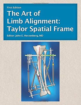 portada The art of Limb Alignment: Taylor Spatial Frame (en Inglés)