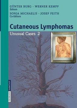 portada cutaneous lymphomas: unusual cases 2 (en Inglés)