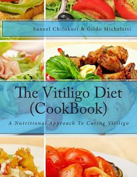 portada The Vitiligo Diet (Cookbook): A Nutritional Approach to Curing Vitiligo (en Inglés)