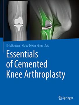 portada Essentials of Cemented Knee Arthroplasty (en Inglés)