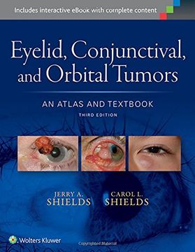 portada Eyelid, Conjunctival, and Orbital Tumors: An Atlas and Textbook