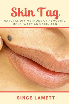 portada Skin Tag: Natural diy Methods of Removing Mole, Wart and Skin tag (en Inglés)