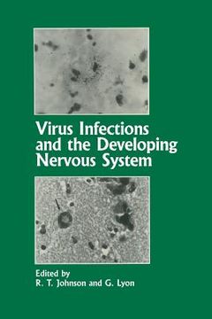 portada Virus Infections and the Developing Nervous System (en Inglés)