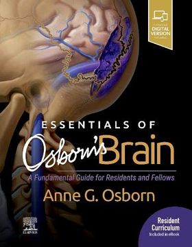 portada Essentials of Osborn's Brain: A Fundamental Guide for Residents and Fellows, 1e 
