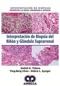 portada Interpretacion de Biopsia del Riñon y Glandula Suprarrenal