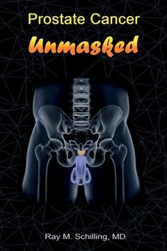 portada Prostate Cancer Unmasked (in English)