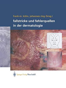 portada Fallstricke und Fehlerquellen in der Dermatologie (en Alemán)