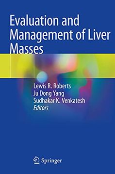 portada Evaluation and Management of Liver Masses (en Inglés)