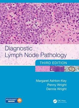 portada Diagnostic Lymph Node Pathology, Third Edition