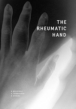 portada The Rheumatic Hand