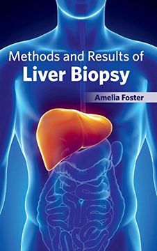 portada Methods and Results of Liver Biopsy (en Inglés)