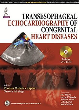 portada Transesophageal Echocardiography of Congenital Heart Diseases (en Inglés)