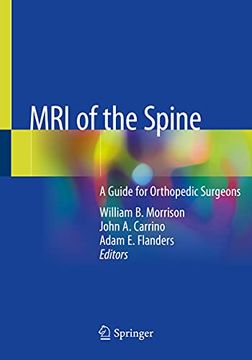 portada Mri of the Spine: A Guide for Orthopedic Surgeons (in English)