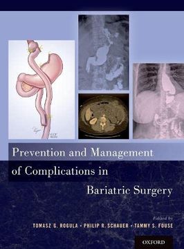 portada Prevention and Management of Complications in Bariatric Surgery (en Inglés)
