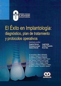 portada El Éxito en Implantología: Diagnóstico, Plan de Tratamiento y Protocolos Operativos