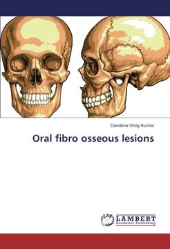 portada Oral fibro osseous lesions