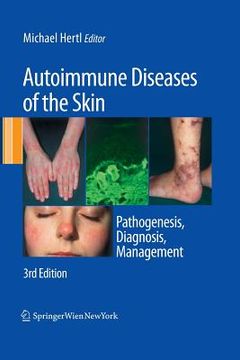 portada Autoimmune Diseases of the Skin: Pathogenesis, Diagnosis, Management (en Inglés)