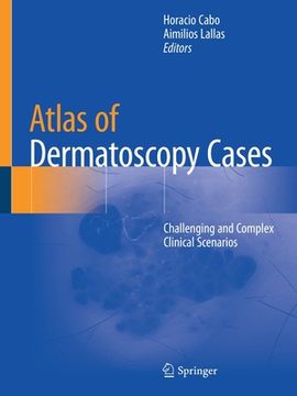 portada Atlas of Dermatoscopy Cases: Challenging and Complex Clinical Scenarios (en Inglés)