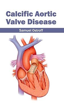 portada Calcific Aortic Valve Disease (en Inglés)