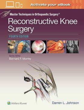 Master Techniques in Orthopaedic Surgery: Reconstructive Knee Surgery (en Inglés)