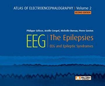 portada Atlas of Electroencephalography -- Volume 2