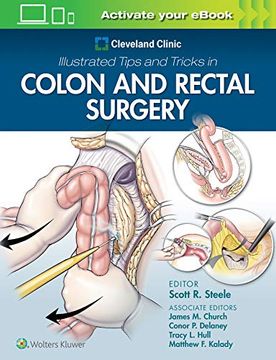 portada Cleveland Clinic Illustrated Tips and Tricks in Colon and Rectal Surgery (en Inglés)